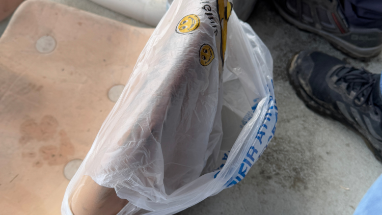 Statta Çekirdek Yiyen Vatandaşın Çöpler İçin Ptatik çözümü